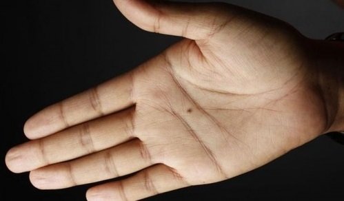 Những nốt ruồi tài lộc nhiều tiền lắm của hình ảnh 2 Nhung not ruoi tai loc nhieu tien lam cua hinh anh 2