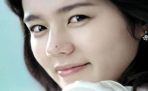 nốt ruồi ở mũi not ruoi o mui