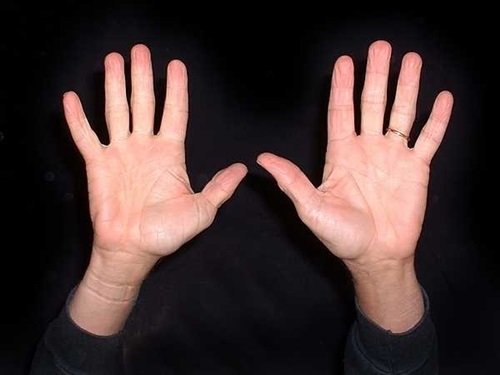 Xem tướng tay vất vả bôn ba đó đây hình ảnh Xem tuong tay vat va bon ba do day hinh anh