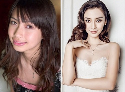 Angela Baby Van trinh thay doi nho phau thuat tham my hinh anh