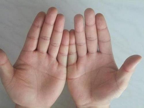 bàn tay có đường cắt ngang ban tay co duong cat ngang
