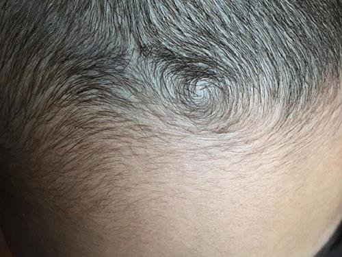 Cha mẹ xem xoáy tóc đỉnh đầu đoán định tương lai con trẻ hình ảnh Cha me xem xoay toc dinh dau doan dinh tuong lai con tre hinh anh