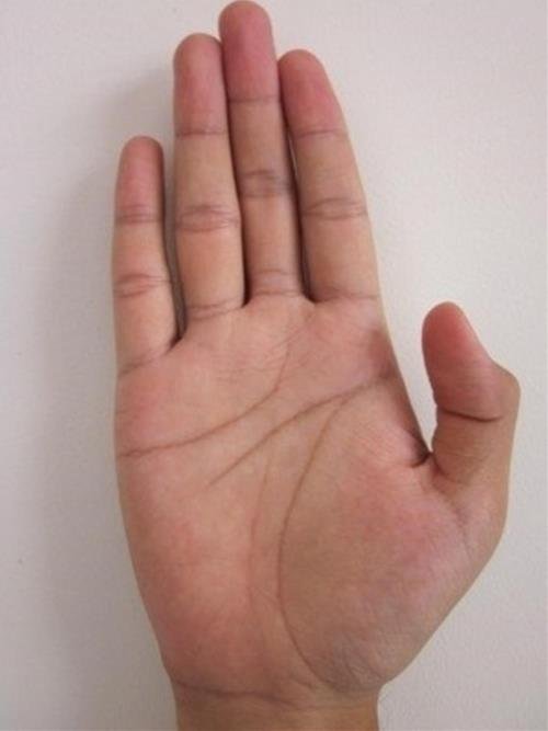 Dấu hiệu đặc biệt Dau hieu dac biet