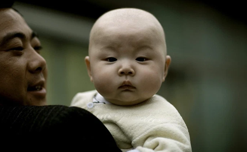 Xương hậu chẩm đầy đặn, đầu không bị lõm Xuong hau cham day dan, dau khong bi lom