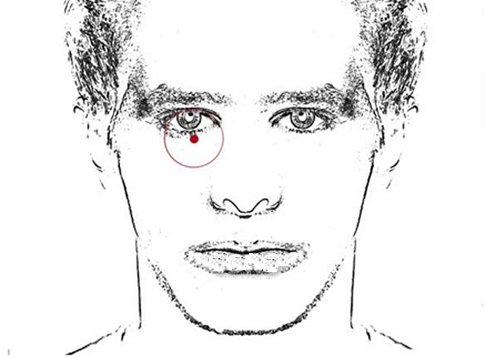 Diem bao xui xeo tu nhung not ruoi xuat hien bat ngo hinh anh 2