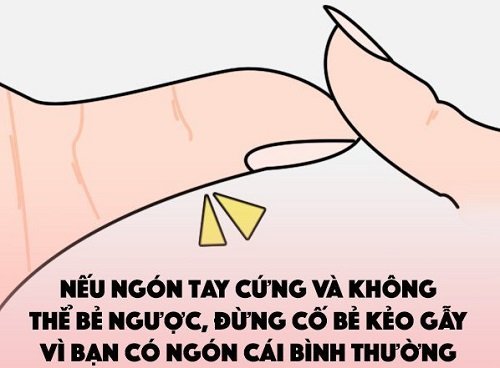 Điều chưa từng công bố về tướng ngón tay cái bẻ ngược hình ảnh 2 Dieu chua tung cong bo ve tuong ngon tay cai be nguoc hinh anh 2