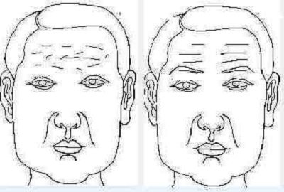 Đọc vị tính cách của bạn qua nếp nhăn trên trán hình ảnh Doc vi tinh cach cua ban qua nep nhan tren tran hinh anh