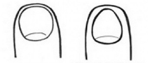 Hình dáng móng tay bật mí nét tính cách thú vị của nữ giới hình ảnh Hinh dang mong tay bat mi net tinh cach thu vi cua nu gioi hinh anh