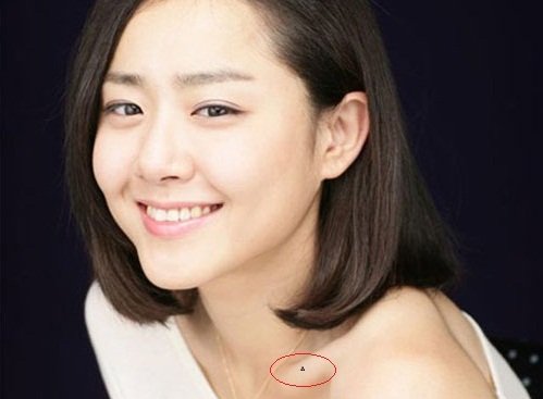 Những nốt ruồi báo hiệu xui xẻo rình rập hình ảnh Nhung not ruoi bao hieu xui xeo rinh rap hinh anh