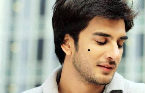 nốt ruồi gò má not ruoi go ma