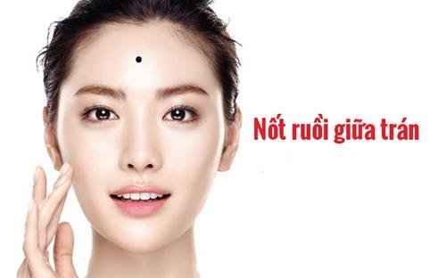 Nốt ruồi may mắn, nốt ruồi giữa trán Not ruoi may man, not ruoi giua tran