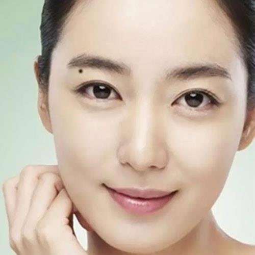 nốt ruồi may mắn ở mí trên not ruoi may man o mi tren