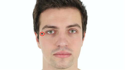 Nốt ruồi ở phía dưới đuôi mắt phải Not ruoi o phia duoi duoi mat phai