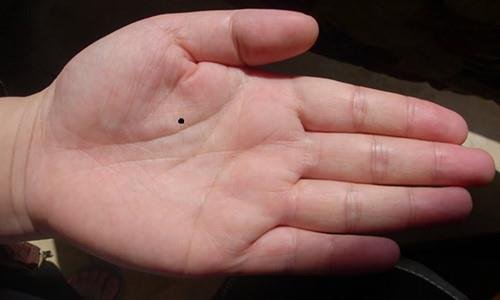 nốt ruồi trong lòng bàn tay not ruoi trong long ban tay