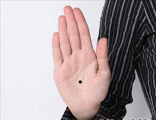 not-ruoi-trong-long-ban-tay not-ruoi-trong-long-ban-tay