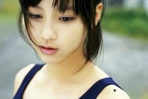 Tim hieu kien thuc co ban ve tuong not ruoi hinh anh 2