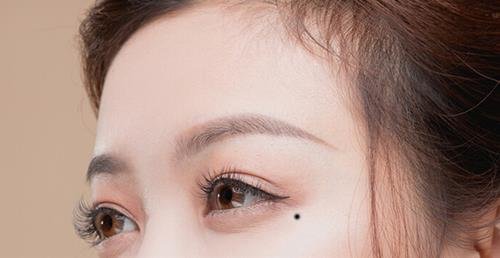 tướng nốt ruồi hợp kinh doanh tuong not ruoi hop kinh doanh