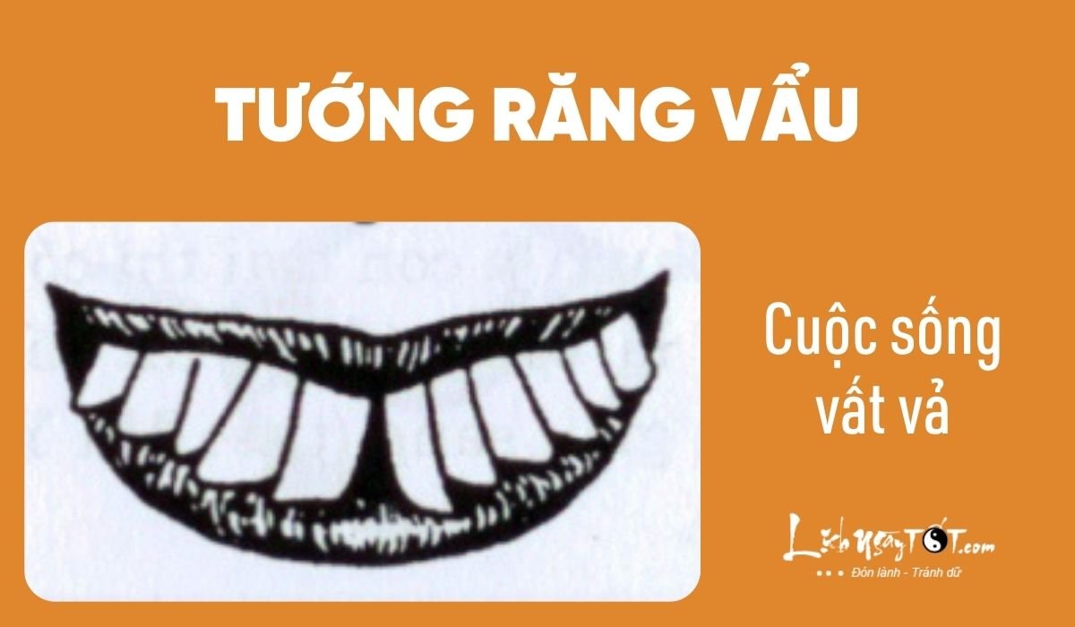 Xem nhân cách qua tướng răng - Răng vẩu Xem nhan cach qua tuong rang - Rang vau