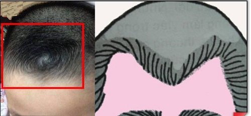 Xem tướng xoáy tóc trên đầu để hiểu thêm về mình hình ảnh gốc Xem tuong xoay toc tren dau de hieu them ve minh hinh anh goc